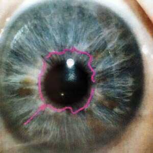 iride-evidenziando-la-siepe