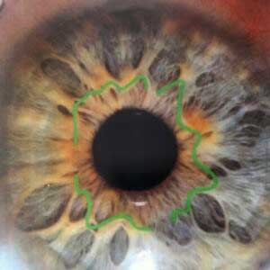 iride-evidenziando-la-siepe